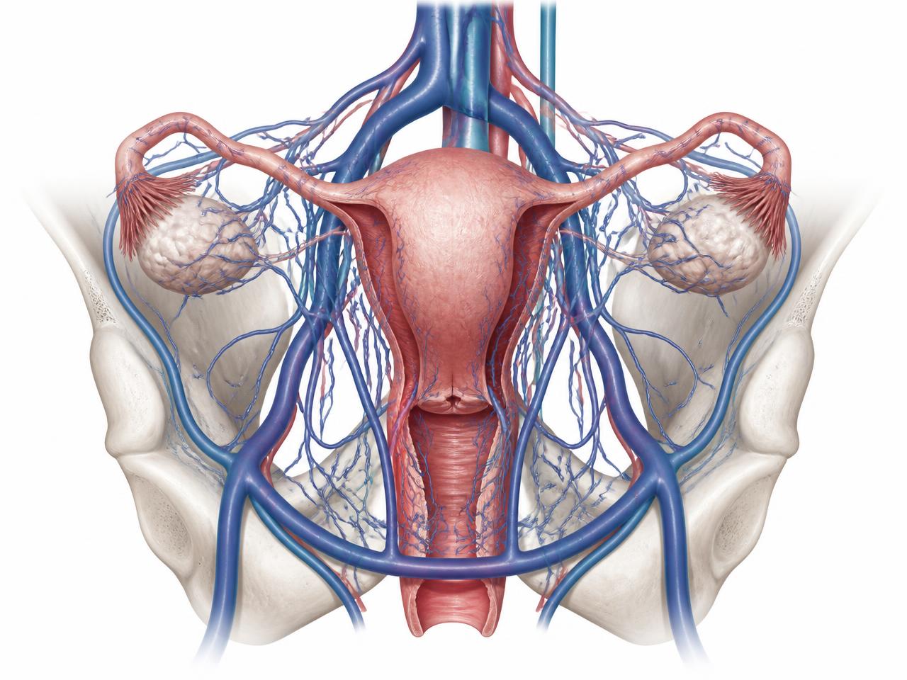 What Is Pelvic Congestion Syndrome? A Complete Guide